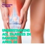 Drawing of knee showing ACL 